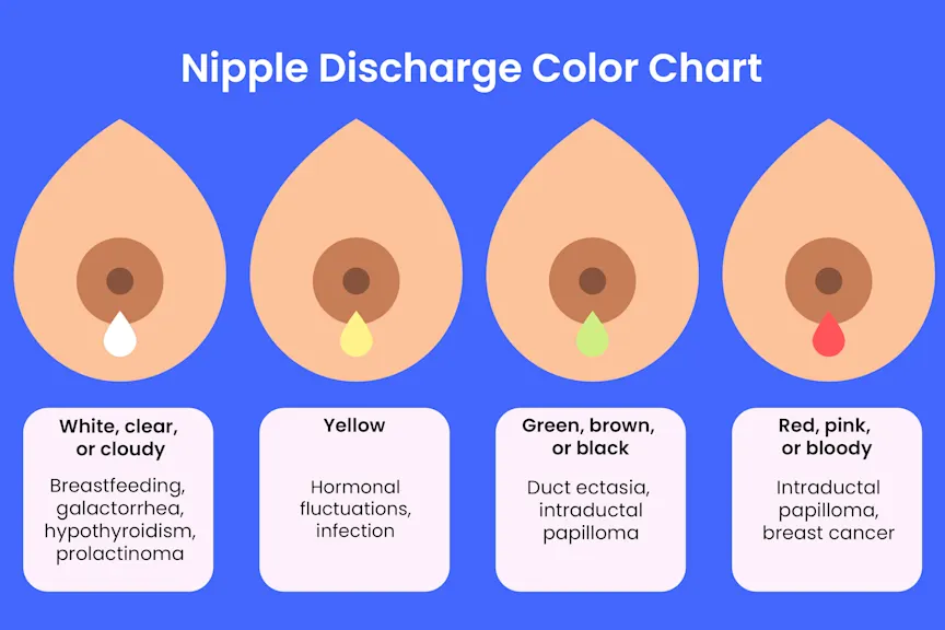 Discharge from Nipple