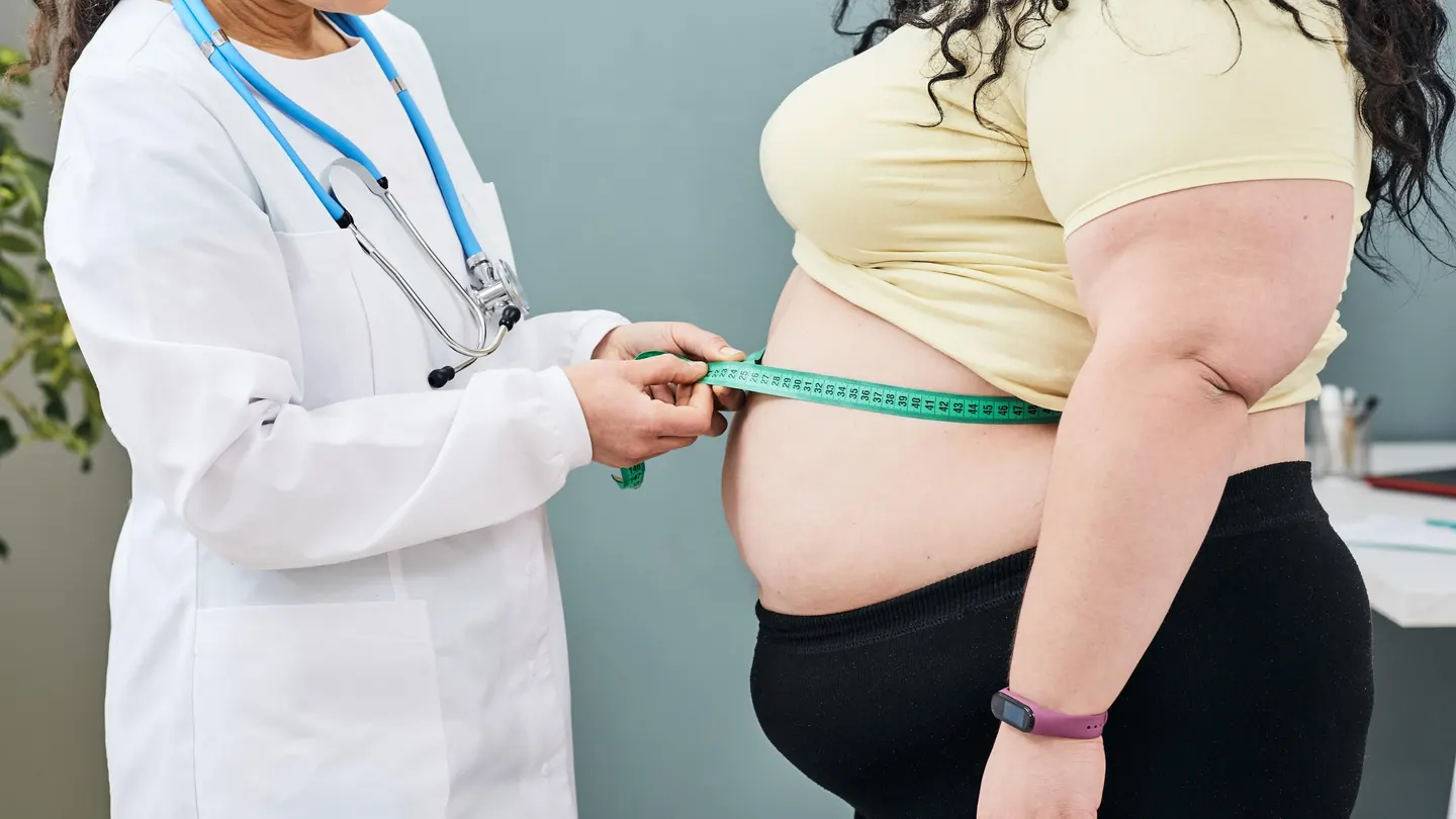 Understanding Obesity by Abbey Wood Hospital