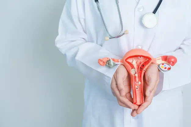 Endometriosis