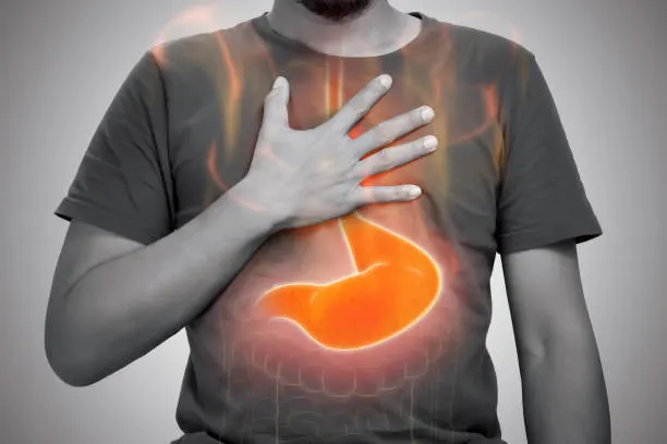 Gastro Oesophageal Reflux