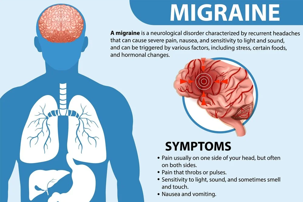 Migraine