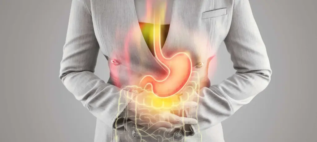 Peptic Ulcers