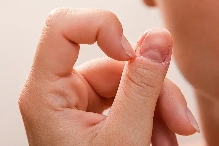 Skin Picking Disorder