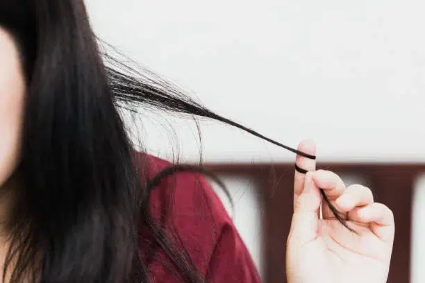 Understanding Trichotillomania