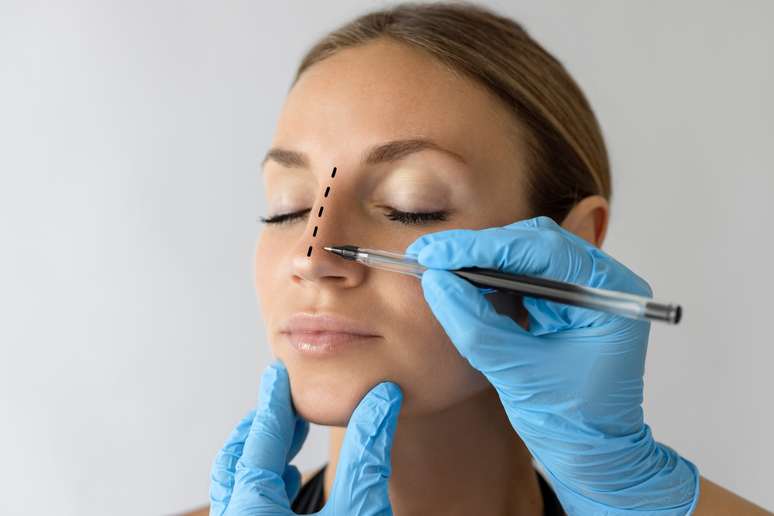 Consultant-led rhinoplasty surgery at Abbey Wood Hospital, North London