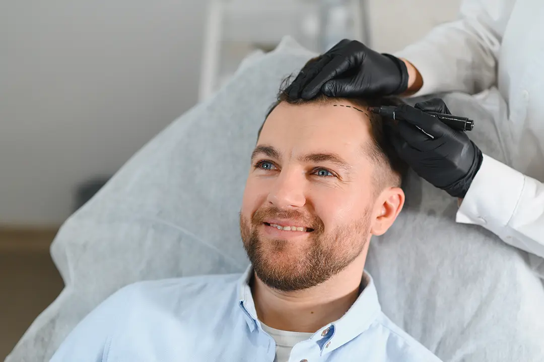 Hair transplant London procedure at Abbey Wood Hospital