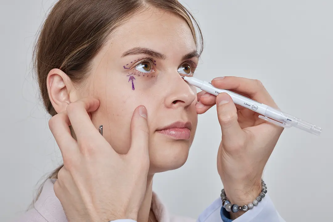 Blepharoplasty (Eyelid Surgery)- What to Expect and Is It Right for You?