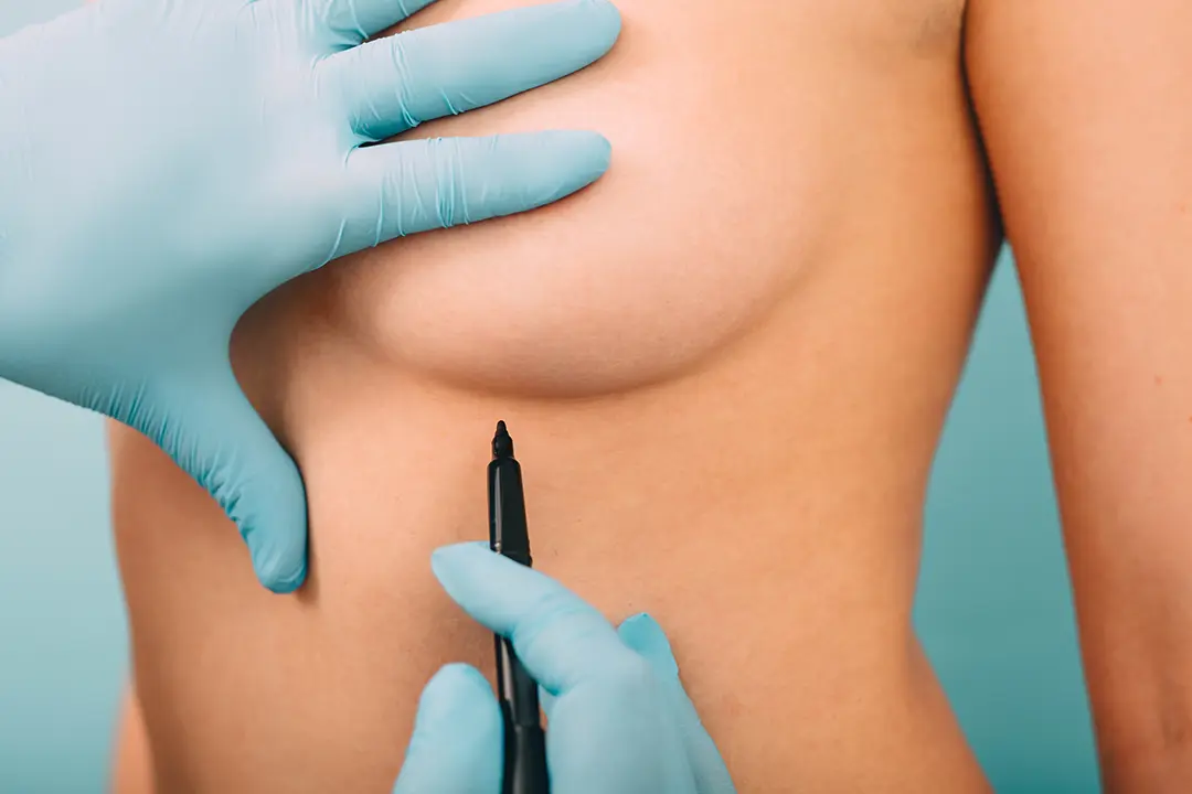 Breast surgery patient consultation with Mr Hakan Tekin at Abbey Wood Hospital London