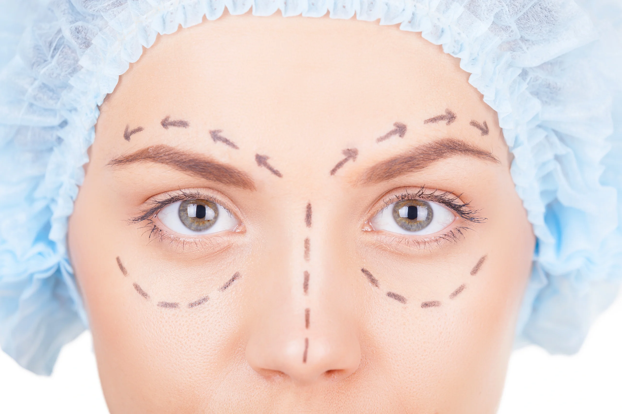 Post-operative aftercare following blepharoplasty eyelid surgery at Abbey Wood Hospital London