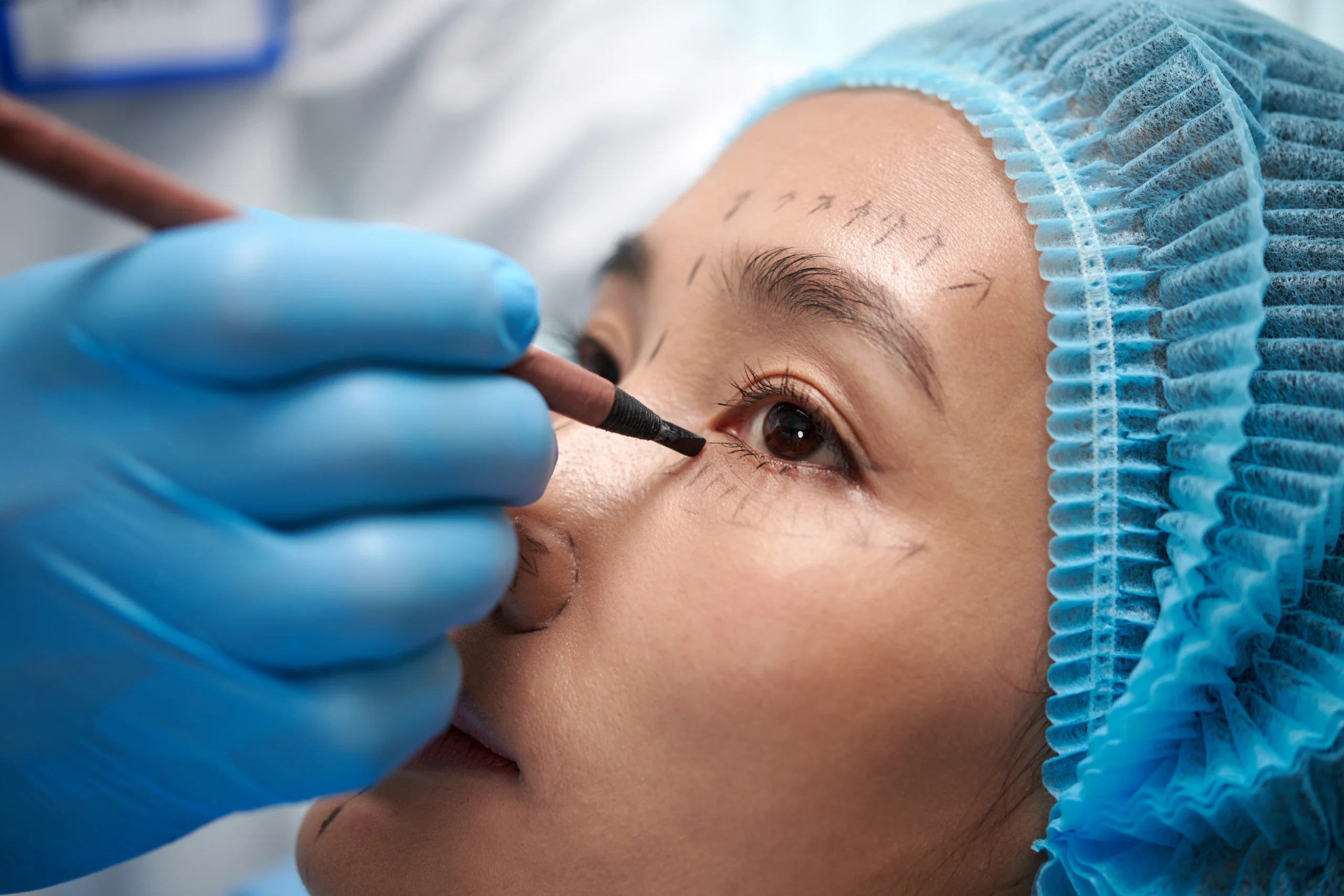 Patient consultation for upper and lower eyelid surgery at a CQC-registered hospital in London