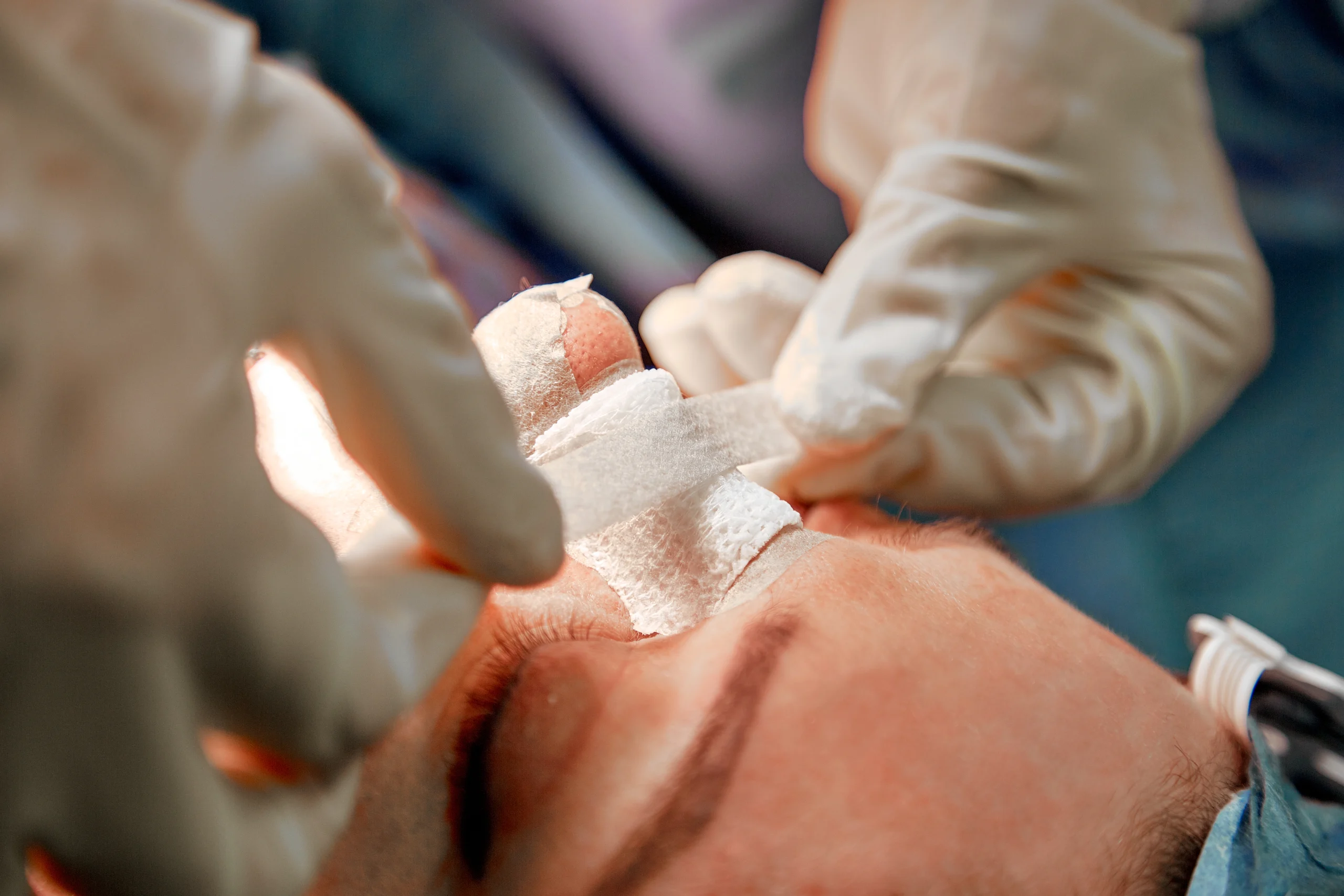 Consultant-led rhinoplasty surgery at Abbey Wood Hospital, North London